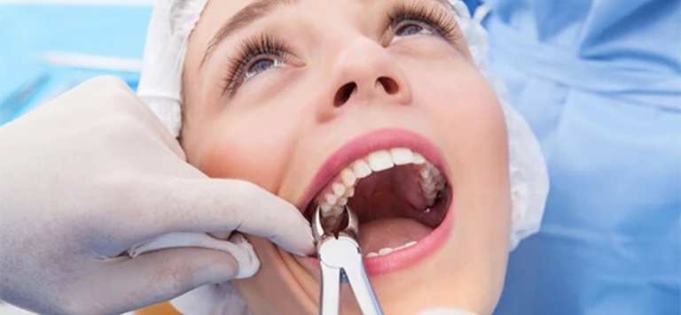 Smiling patient after successful tooth extraction