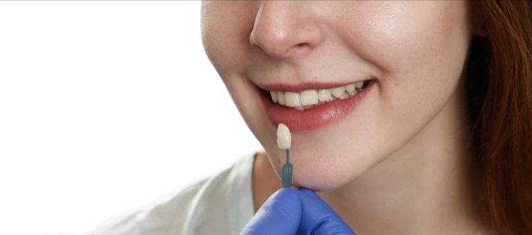 Maintain Dental Crowns For Longevity