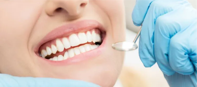 Five different teeth whitening methods for achieving a radiant smile