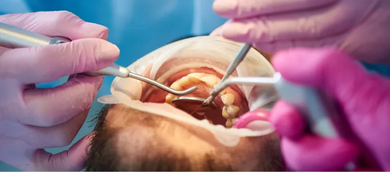 A patient preparing for all-on-4 dental implant surgery