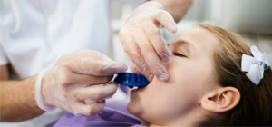 The Do’s And Don’ts Of Post-Tooth Extraction Care